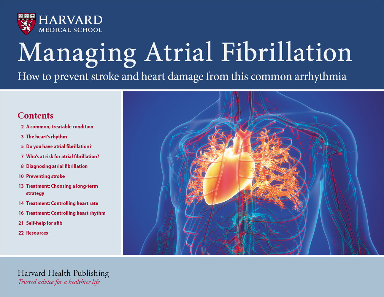 AtrialFibrillation_AFIB0523_cover