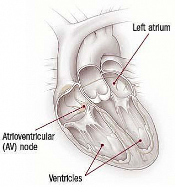 Different types of rapid heart rhythms featured image