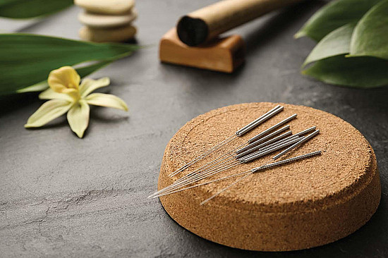 Can acupuncture ease your sciatica? featured image