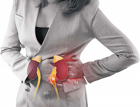 Kidney stones: From agony to action featured image